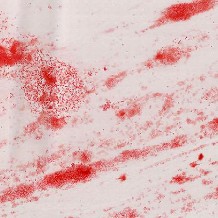 gonococci - définition - What is