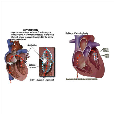 Medical Visual Aids Medical Visual Aids