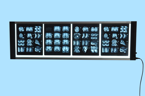 Medical X-ray illuminator (X-ray view box) Medical X-ray illuminator (X-ray view box)