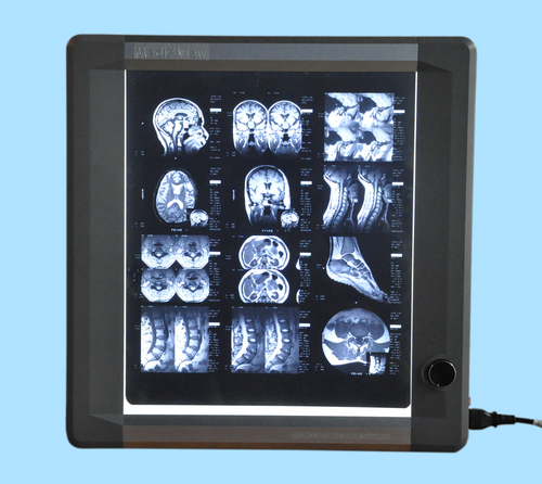 Economical LED Based Single Film Viewer Economical LED Based Single Film Viewer