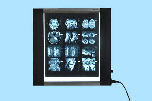 X-ray illuminator (X-ray view box) X-ray illuminator (X-ray view box)