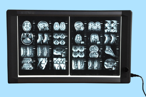 Programmable Digital X-ray Illuminator Programmable Digital X-ray Illuminator