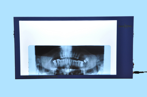 Dental OPG and Ceptelogram viewer Dental OPG and Ceptelogram viewer