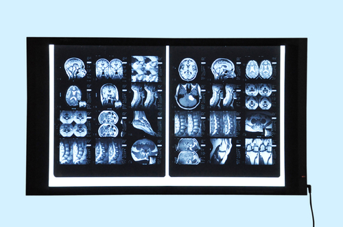 Medical X-ray illuminator with external power Medical X-ray illuminator with external power
