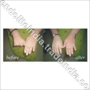 Silicone Fingers Silicone Fingers