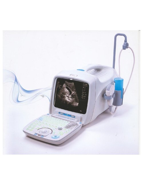 Fetal Monitor Fetal Monitor