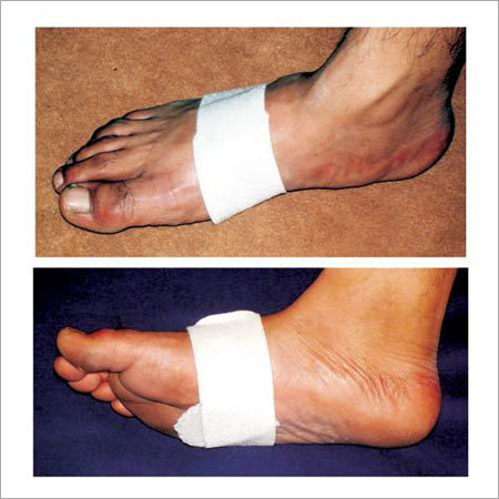 Metatarsal Support Metatarsal Support