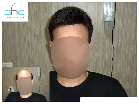 Hair Fixing Services Hair Fixing Services