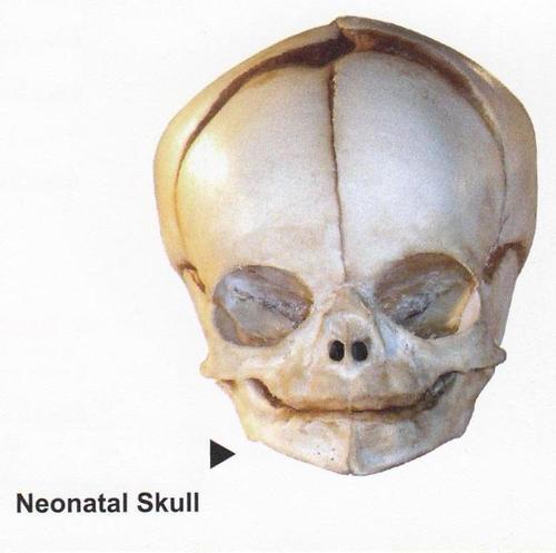 NEONATAL SKULL NEONATAL SKULL