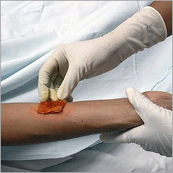 Povidon Iodine Solution Povidon Iodine Solution