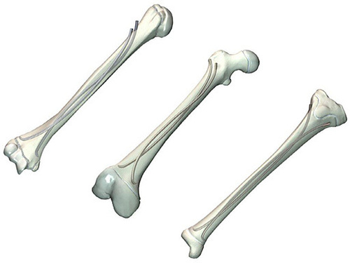 Titanium Elastic Nail Titanium Elastic Nail