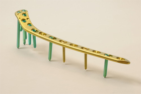 Locking Proximal Lateral Tibia Plate Locking Proximal Lateral Tibia Plate