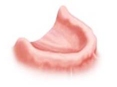 Dental Implants For All Missing Teeth Dental Implants For All Missing Teeth
