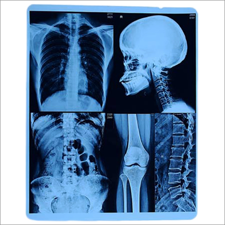 X-Ray Printing Film X-Ray Printing Film