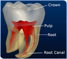 Single Sitting Root Canal Treatment Single Sitting Root Canal Treatment