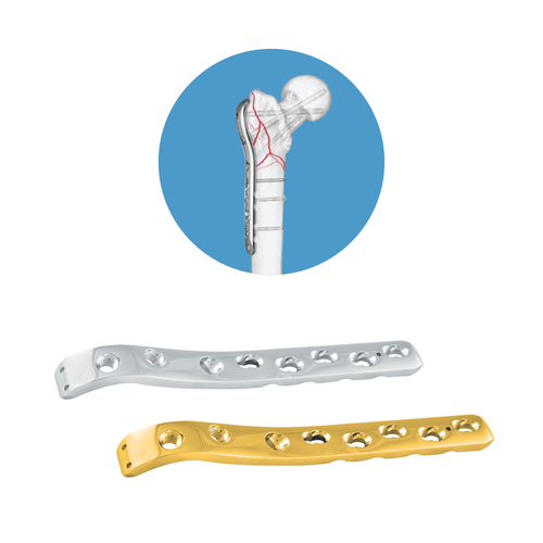 Locking Proximal Femur Plate Locking Proximal Femur Plate
