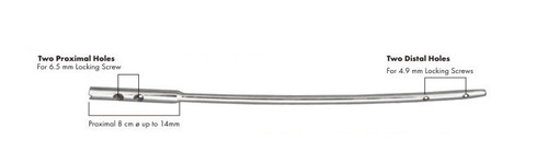 Femoral Reconstruction Nails (Left Leg) Femoral Reconstruction Nails (Left Leg)