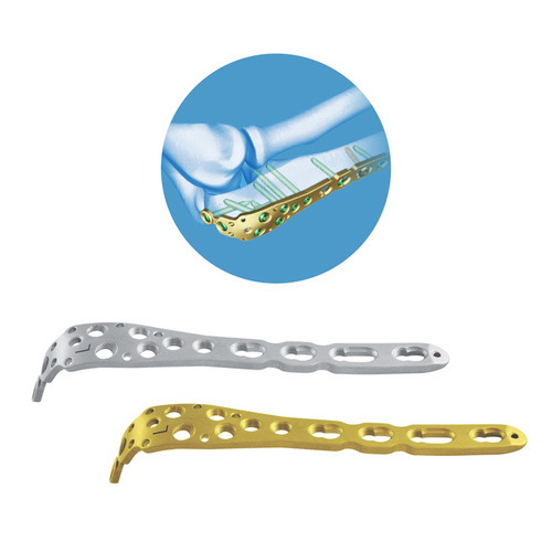 Locking Olecranon Plate 3.5/4.0MM Locking Olecranon Plate 3.5/4.0MM