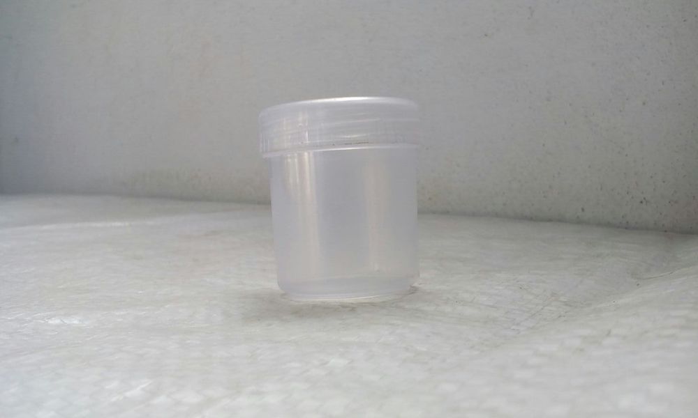 Plastic Urine Container Plastic Urine Container
