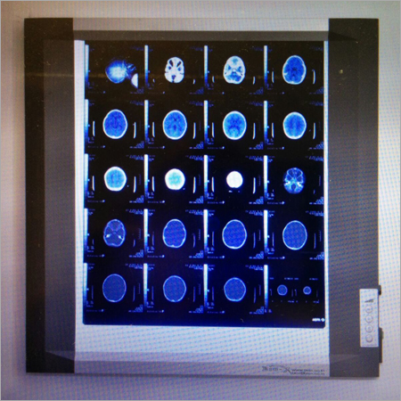 LED X Ray Films LED X Ray Films