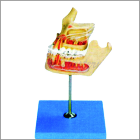 Pathologic Tooth With Jaw Pathologic Tooth With Jaw