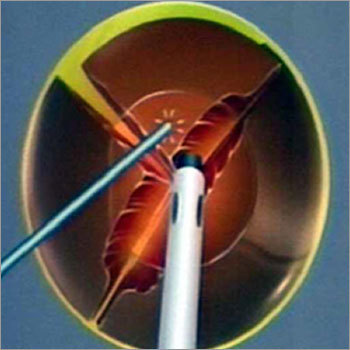 Phaco Equipment Phaco Equipment