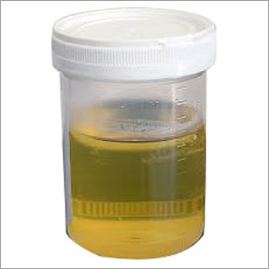 Urine Bottle Urine Bottle