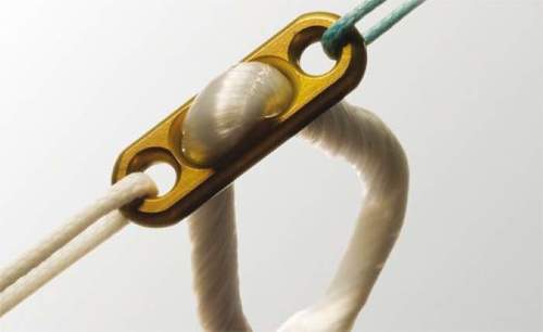 ortho implants ortho implants